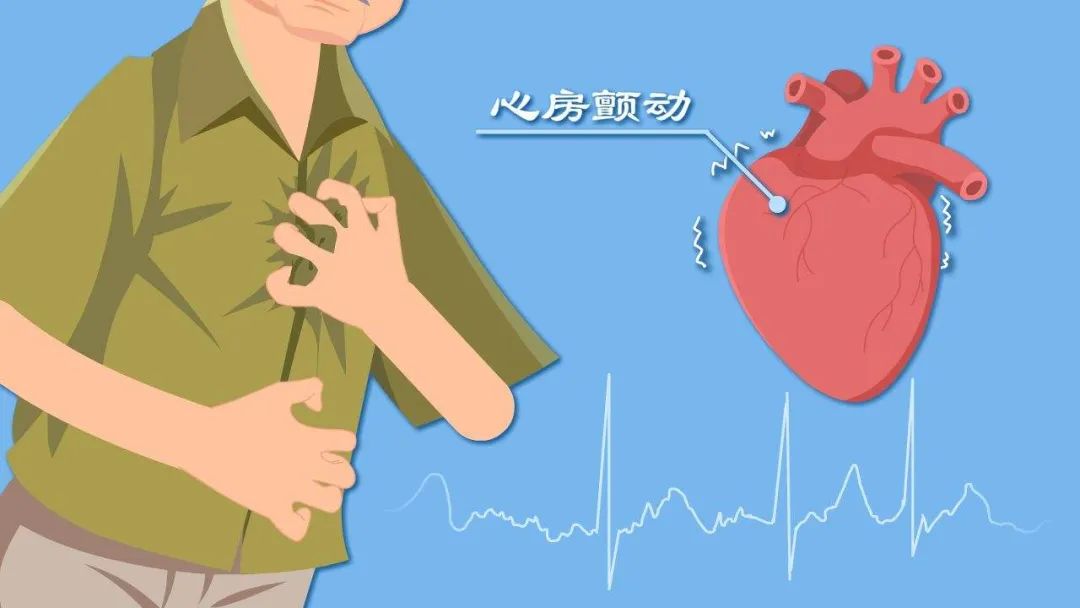 科普 | 關(guān)于房顫的你了解多少？快避開這些誤區(qū)！