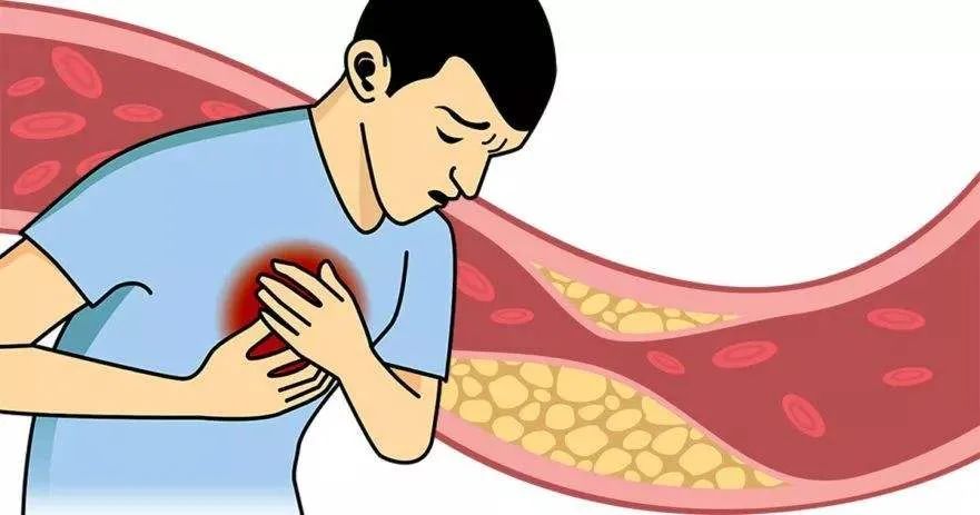 高膽固醇不能吃雞蛋？膽固醇也有“好壞”之分！