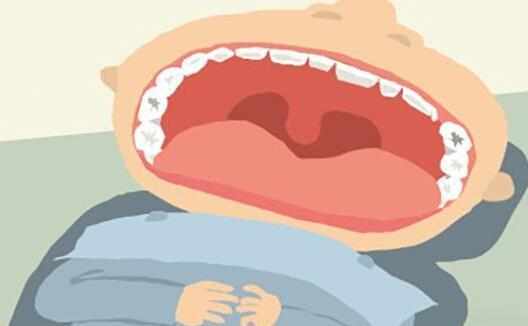 口苦口臭又磨牙”千萬別大意！這是胃向你發(fā)出的“求救信號”