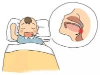 9歲男孩睡覺打鼾，醫(yī)生：嚴重會影響智力發(fā)育！