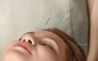 秋季到，鼻炎鬧，得了鼻炎怎么辦？中醫(yī)：改善體質(zhì)是關(guān)鍵！
