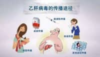 這種肝炎會(huì)傳染，治療沒(méi)選對(duì)會(huì)發(fā)展成肝癌！