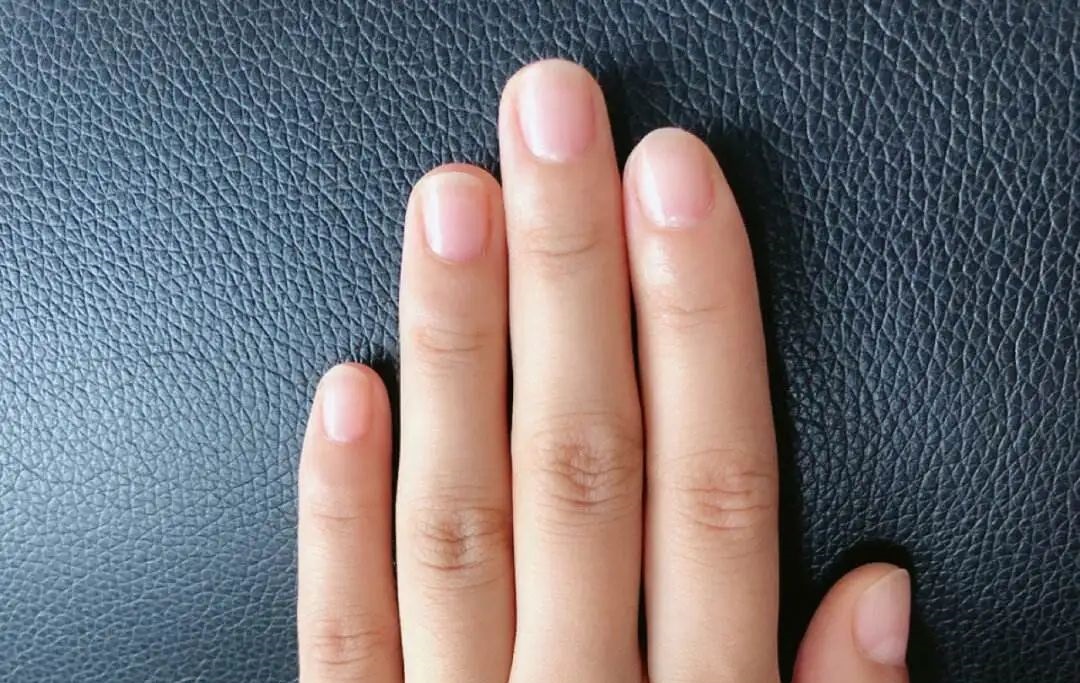 身體好不好，看看指甲就知道？指甲出現(xiàn)這10種情況要留意！